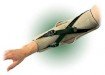 Anatech Hyperextension Elbow - Please contact for pricing.